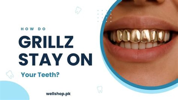 How do Grillz stay on your teeth?