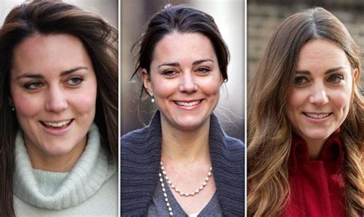 Is Kate Middleton planning a makeover involving plastic surgery?